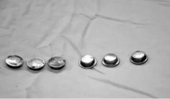 注意了 人體顱內植入磁鐵片治療癲癇不可靠